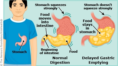 KidsHealth Image